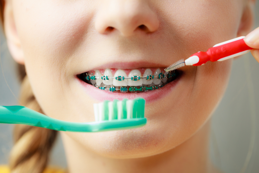 Oral Hygiene Tips for Kids